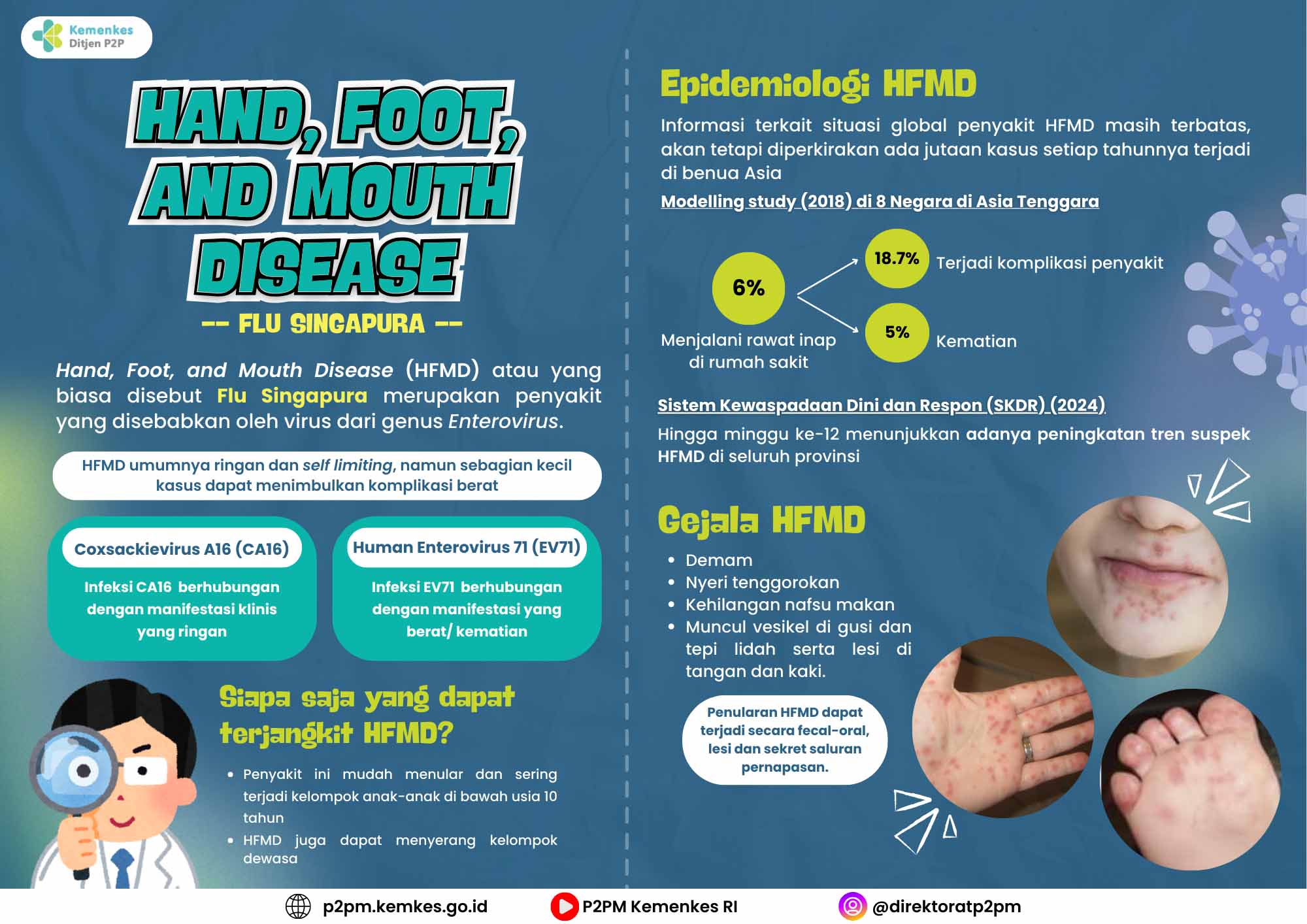 Hand, Foot, and Mouth Disease (HFMD)